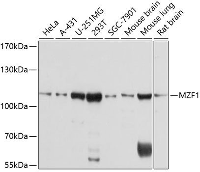 MZF1 Rabbit Polyclonal Antibody