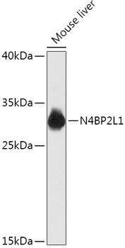 N4BP2L1 Rabbit Polyclonal Antibody