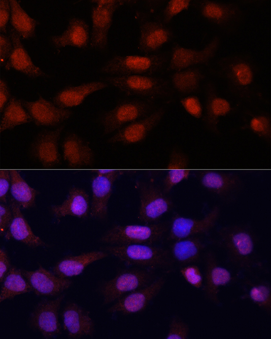 N5-Methylcytidine Rabbit Polyclonal Antibody