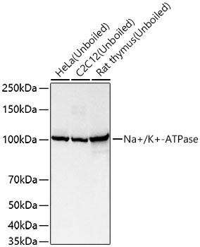Na+/K+-ATPase Rabbit Monoclonal Antibody - Image 3