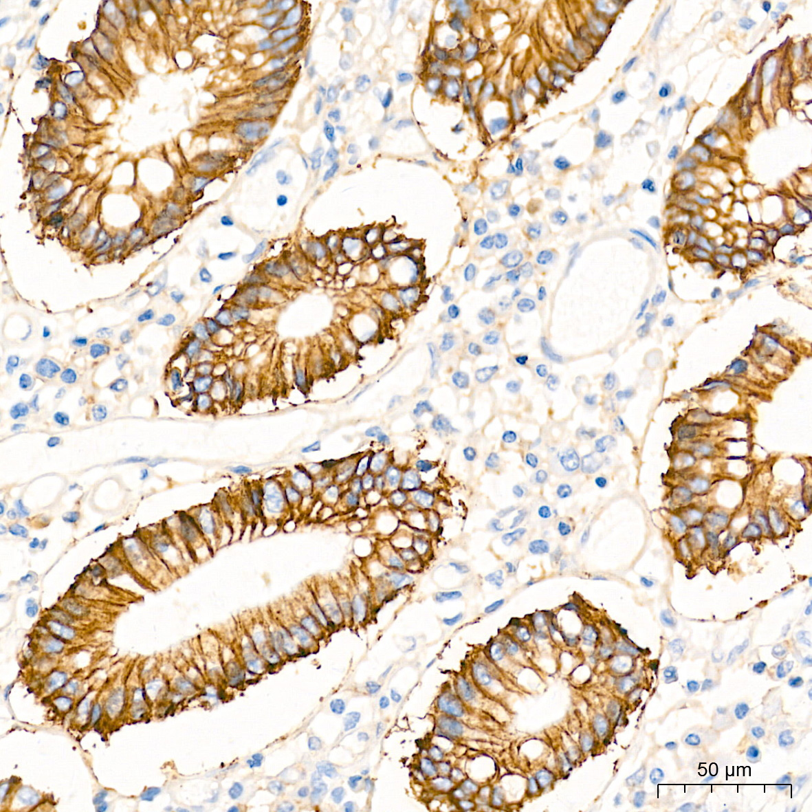 Na+/K+-ATPase Rabbit Monoclonal Antibody - Image 5