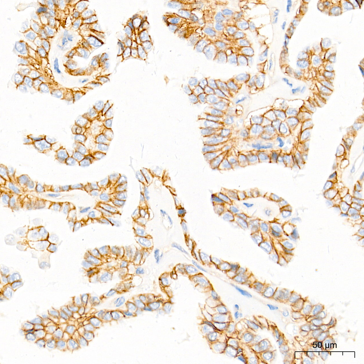 Na+/K+-ATPase Rabbit Monoclonal Antibody - Image 6