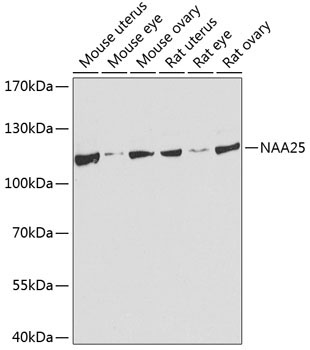 NAA25 Rabbit Polyclonal Antibody