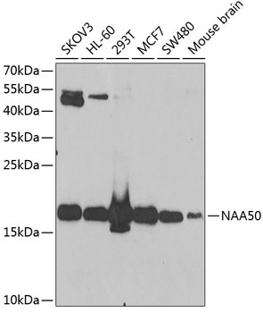 NAA50 Rabbit Polyclonal Antibody