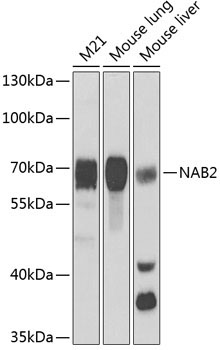 NAB2 Rabbit Polyclonal Antibody