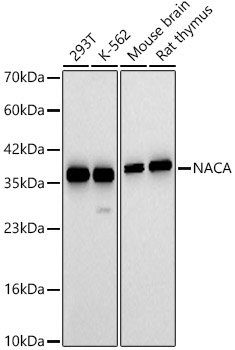 NACA Rabbit Polyclonal Antibody