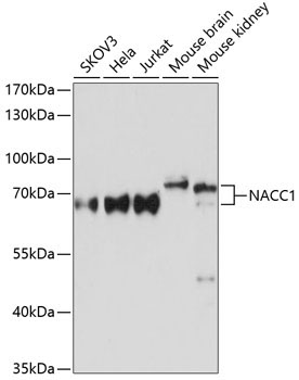 NACC1 Rabbit Polyclonal Antibody