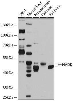 NADK Rabbit Polyclonal Antibody