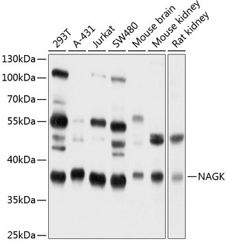 NAGK Rabbit Polyclonal Antibody