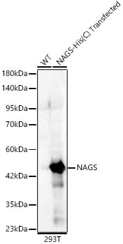 NAGS Rabbit Polyclonal Antibody