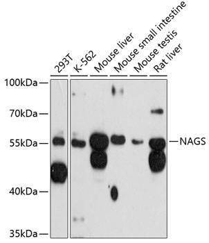 NAGS Rabbit Polyclonal Antibody