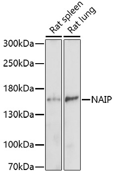 NAIP Rabbit Polyclonal Antibody