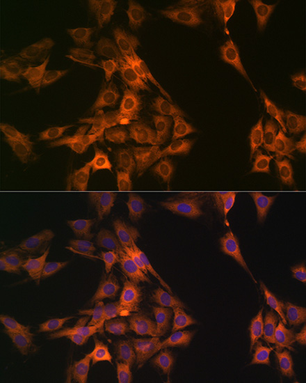 NAP1L1 Rabbit Monoclonal Antibody - Image 3