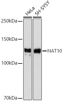 NAT10 Rabbit Monoclonal Antibody
