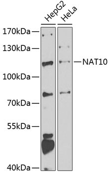 NAT10 Rabbit Polyclonal Antibody
