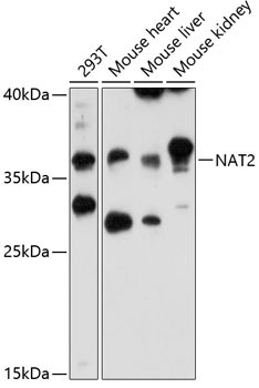NAT2 Rabbit Polyclonal Antibody
