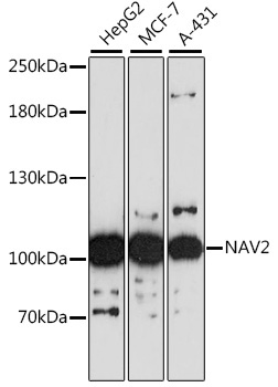 NAV2 Rabbit Polyclonal Antibody