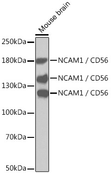 NCAM1 / CD56 Rabbit Polyclonal Antibody