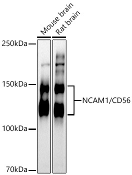 NCAM1 / CD56 Rabbit Polyclonal Antibody