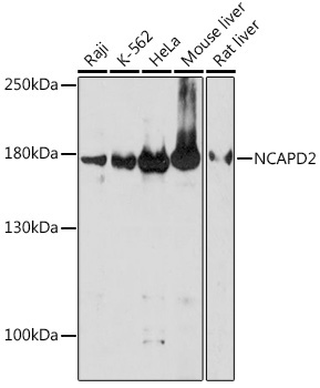 NCAPD2 Rabbit Polyclonal Antibody