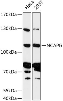 NCAPG Rabbit Polyclonal Antibody
