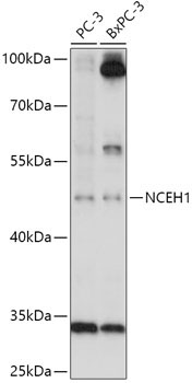 NCEH1 Rabbit Polyclonal Antibody