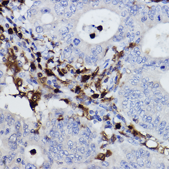 NCF4/p40-phox Rabbit Monoclonal Antibody - Image 2