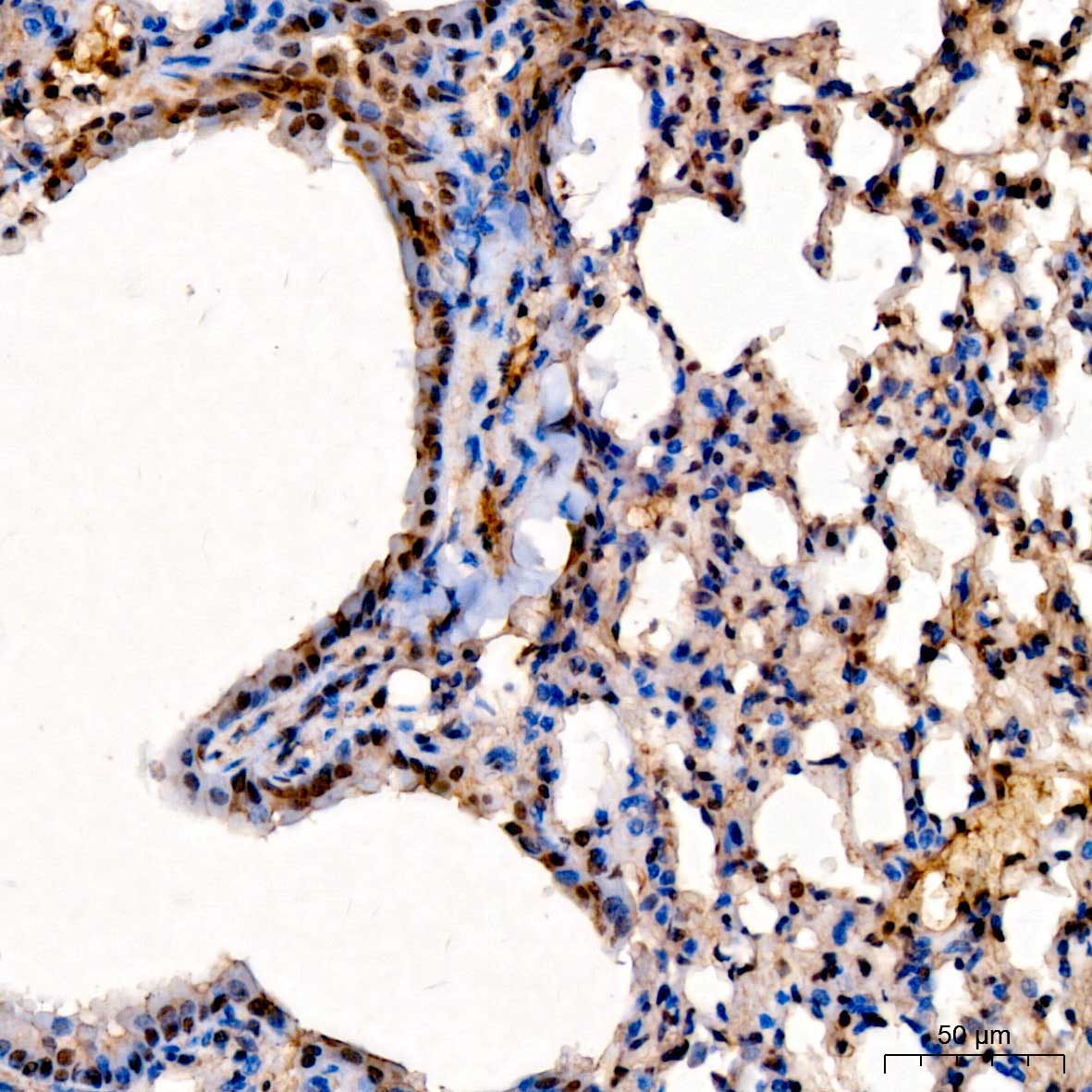 NCOA4 Rabbit Polyclonal Antibody - Image 2
