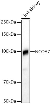 NCOA7 Rabbit Polyclonal Antibody