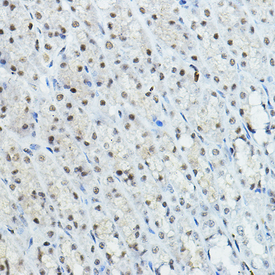 NCOR1 Rabbit Polyclonal Antibody - Image 2