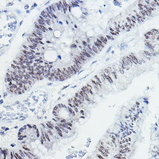 NCOR1 Rabbit Polyclonal Antibody - Image 3