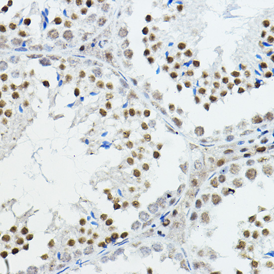 NCOR1 Rabbit Polyclonal Antibody - Image 4
