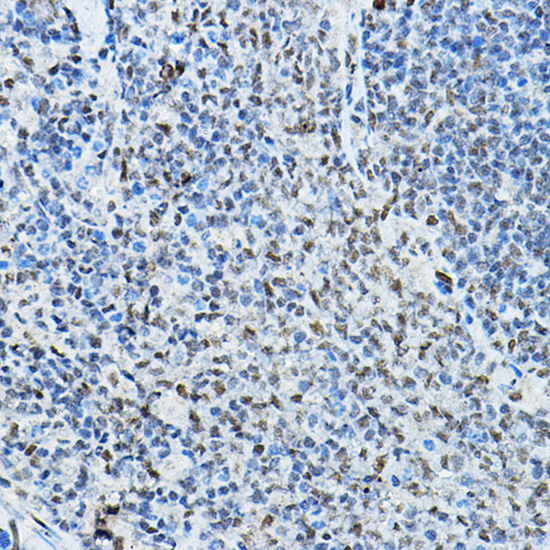 NCOR2 Rabbit Polyclonal Antibody - Image 2