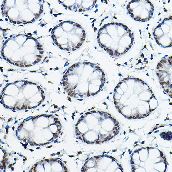 NCOR2 Rabbit Polyclonal Antibody - Image 3