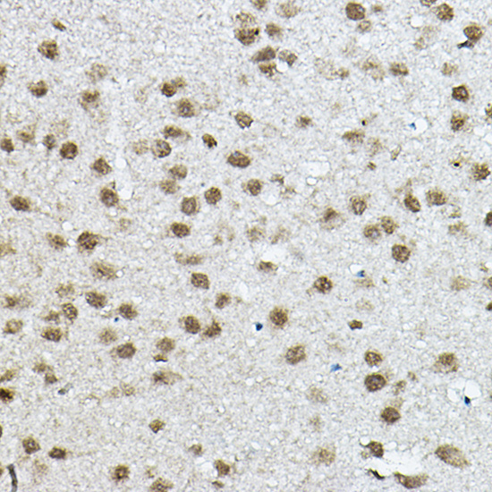 NCOR2 Rabbit Polyclonal Antibody - Image 4