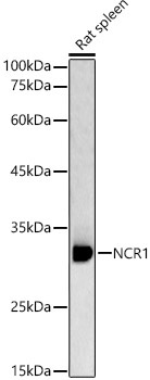 NCR1 Rabbit Polyclonal Antibody