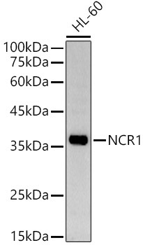NCR1 Rabbit Polyclonal Antibody