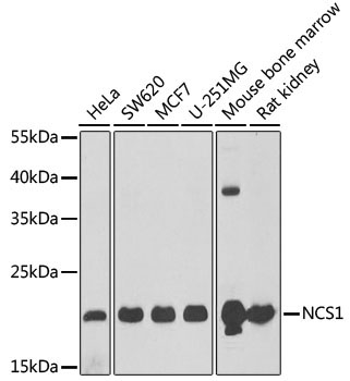 NCS1 Rabbit Polyclonal Antibody