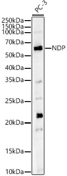 NDP Rabbit Polyclonal Antibody