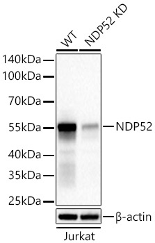 NDP52 Rabbit Monoclonal Antibody