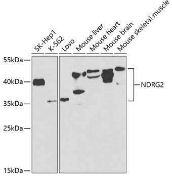NDRG2 Rabbit Polyclonal Antibody