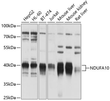 NDUFA10 Rabbit Polyclonal Antibody