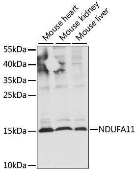 NDUFA11 Rabbit Polyclonal Antibody