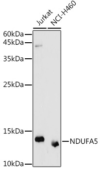 NDUFA5 Rabbit Polyclonal Antibody