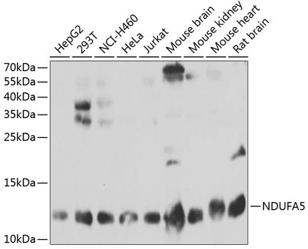 NDUFA5 Rabbit Polyclonal Antibody