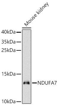 NDUFA7 Rabbit Polyclonal Antibody