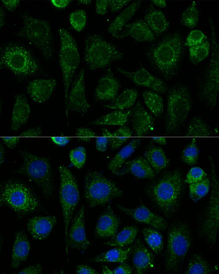 NDUFAB1 Rabbit Polyclonal Antibody