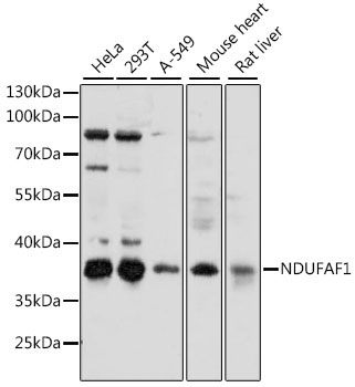 NDUFAF1 Rabbit Polyclonal Antibody