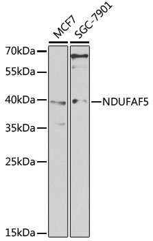 NDUFAF5 Rabbit Polyclonal Antibody