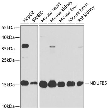 NDUFB5 Rabbit Polyclonal Antibody